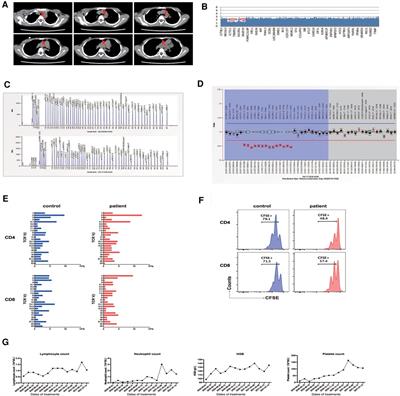 Case report: Effectiveness of sirolimus in treating partial DiGeorge Syndrome with Autoimmune Lymphoproliferative Syndrome (ALPS)-like features